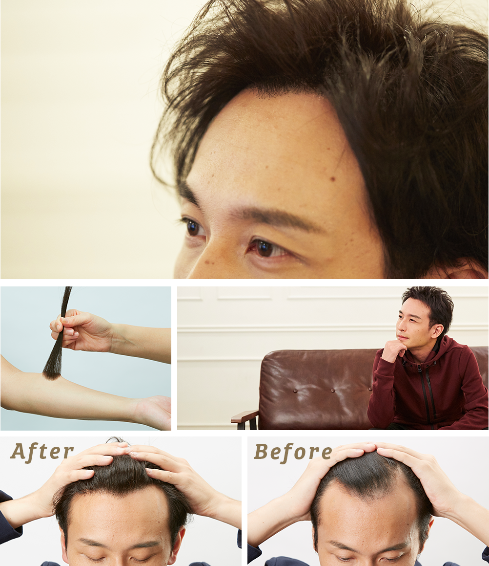 男性ビフォーアフター