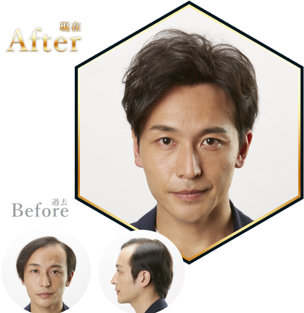 Before 過去 After 現在
