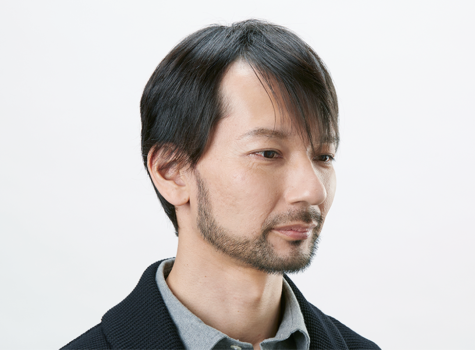 ミライズ着用前後の比較画像のうちの1枚目。ミライズを着用する前の男性の写真。従来の長めなカツラを着用しているが元気がない様子。