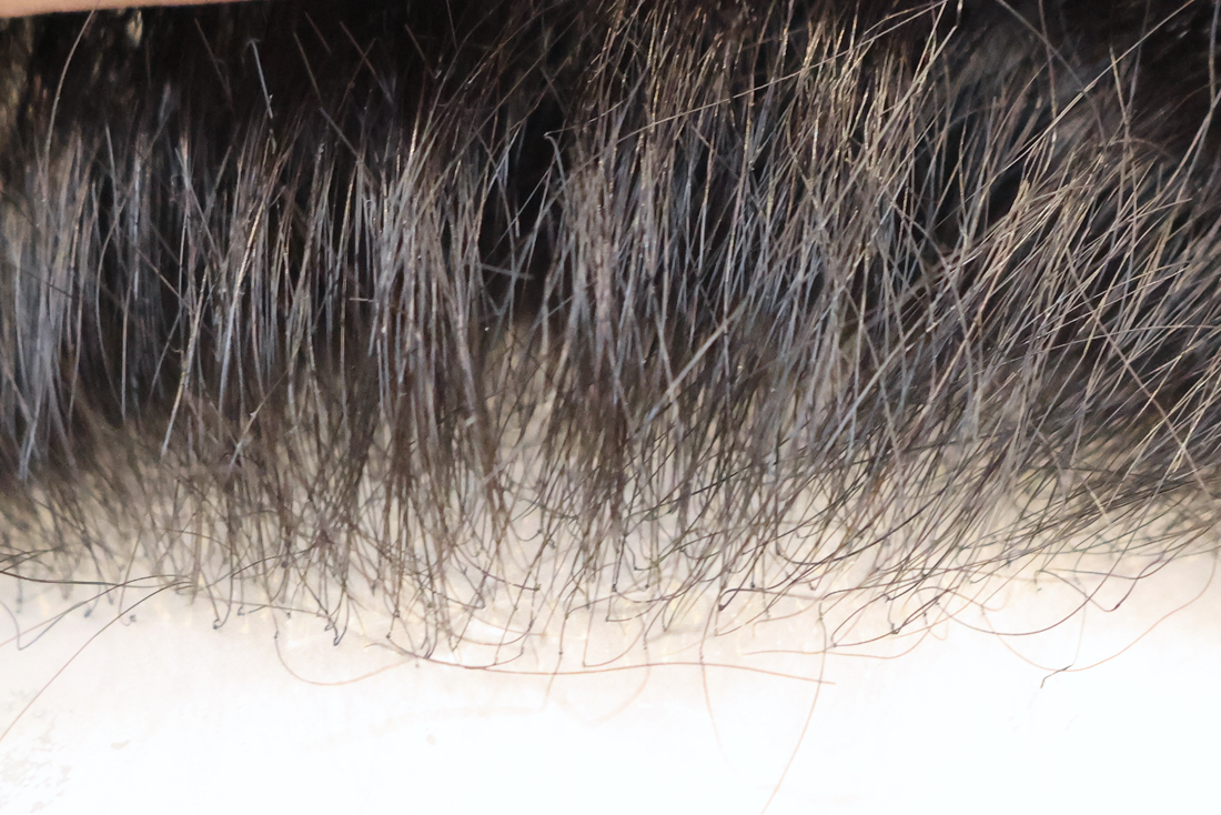 ミライズの生え際をクローズアップした写真。生え際が自然で根元が地肌に自然に溶け込んでいる。