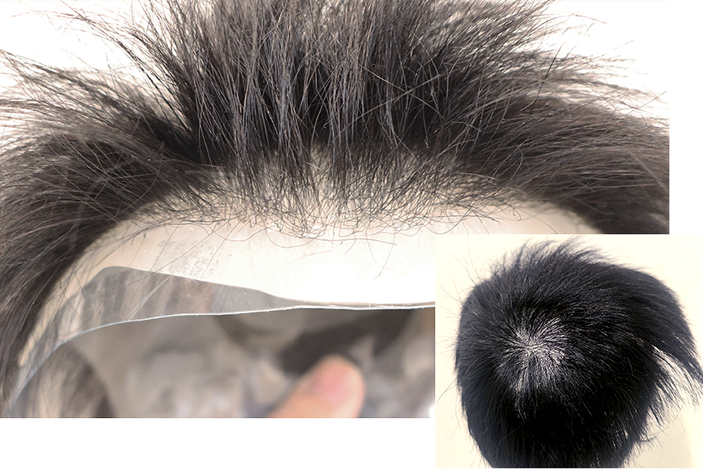 ミライズ本体の生え際の拡大写真。ひとりひとりに専用のスタイルを調整している。つむじの位置を調整している写真も添えられている。