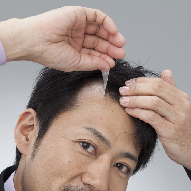 ヘアコンタクト 前髪の剃り込みがきになる方 ヘアコンタクト 増毛 育毛 発毛のプロピア Propia